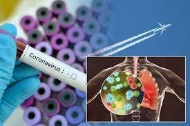 İranda ötən sutka koronavirusdan 669 nəfər ölüb
